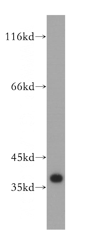 human brain tissue were subjected to SDS PAGE followed by western blot with Catalog No:114143(PPP1CB antibody) at dilution of 1:1500