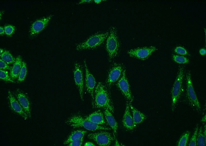 Immunofluorescent analysis of HepG2 cells using Catalog No:109440(COL8A1 Antibody) at dilution of 1:50 and Alexa Fluor 488-congugated AffiniPure Goat Anti-Rabbit IgG(H+L)