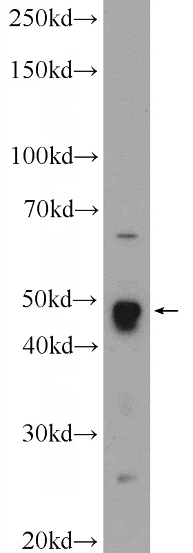 mouse testis tissue were subjected to SDS PAGE followed by western blot with Catalog No:112405(LYAR Antibody) at dilution of 1:1000