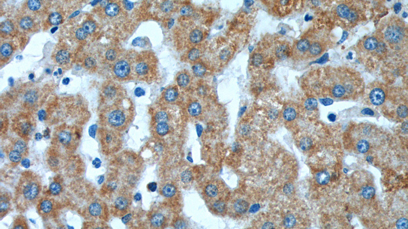 Immunohistochemistry of paraffin-embedded human liver tissue slide using Catalog No:116173(TOMM40 Antibody) at dilution of 1:200 (under 40x lens).