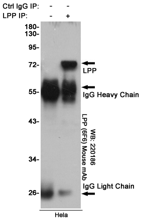 Immunoprecipitation analysis of Hela cell lysates using LPP (6F6) Mouse mAb.