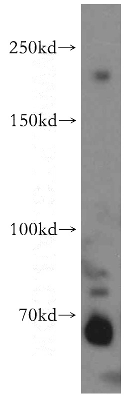 HeLa cells were subjected to SDS PAGE followed by western blot with Catalog No:116933(ZCCHC11 antibody) at dilution of 1:300