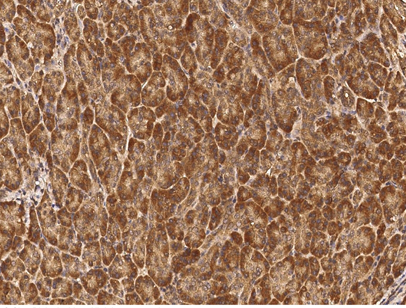MCTS1 / Malignant T cell amplified sequence 1 Antibody, Rabbit PAb, Antigen Affinity Purified, Immunohistochemistry