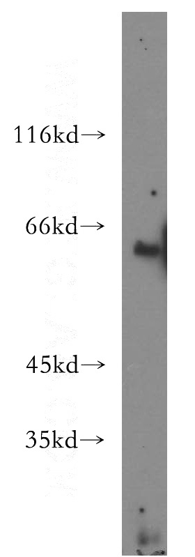 HEK-293 cells were subjected to SDS PAGE followed by western blot with Catalog No:107700(ACSM3 antibody) at dilution of 1:500