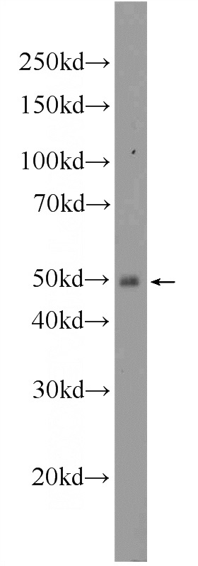 mouse spleen tissue were subjected to SDS PAGE followed by western blot with Catalog No:110334(ENTPD6 Antibody) at dilution of 1:600