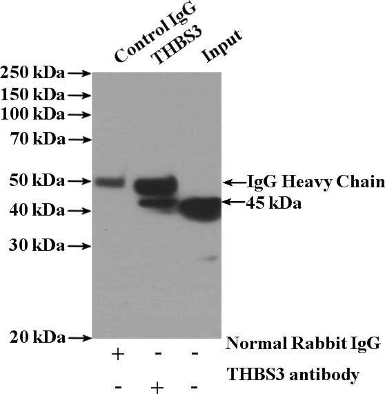 IP Result of anti-THBS3-Specific (IP:Catalog No:116055, 4ug; Detection:Catalog No:116055 1:1000) with mouse kidney tissue lysate 4000ug.