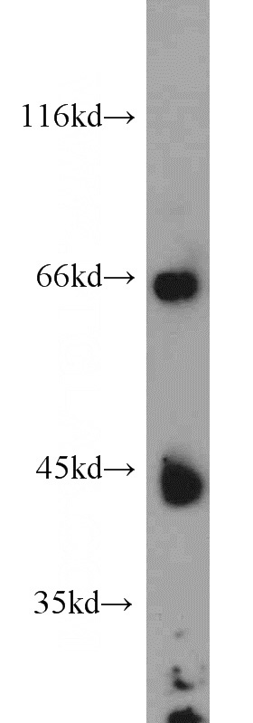 mouse liver tissue were subjected to SDS PAGE followed by western blot with Catalog No:112242(LIPC antibody) at dilution of 1:500