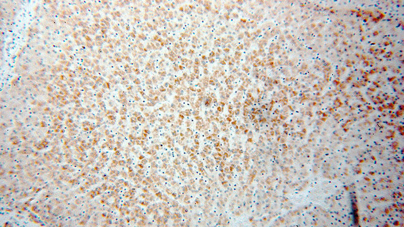 Immunohistochemical of paraffin-embedded human liver using Catalog No:116234(TRAF6 antibody) at dilution of 1:50 (under 10x lens)