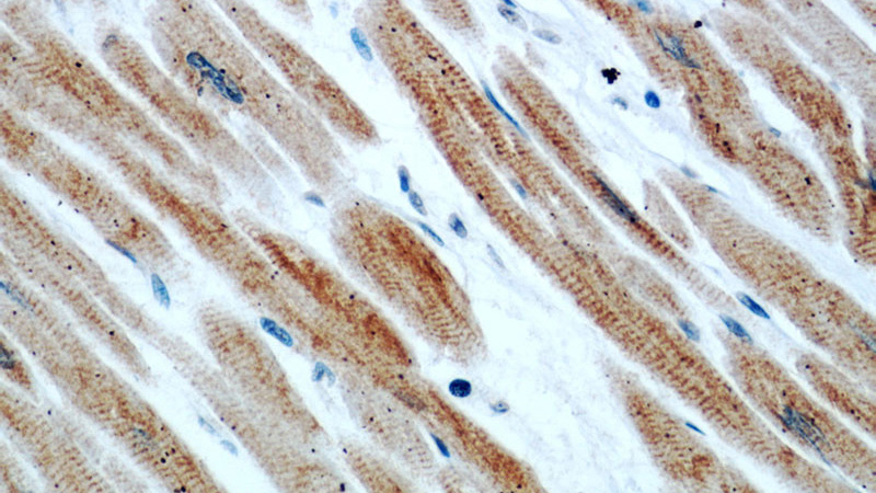Immunohistochemical of paraffin-embedded human heart using Catalog No:109897(DES antibody) at dilution of 1:50 (under 40x lens)