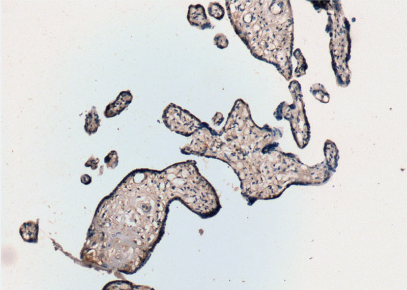 Immunohistochemistry of paraffin-embedded human placenta tissue slide using Catalog No:110306(EDNRB Antibody) at dilution of 1:50 (under 10x lens)