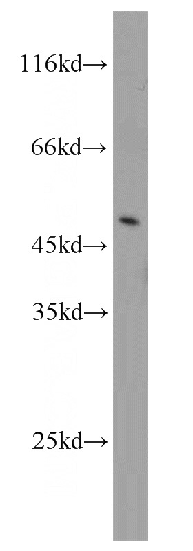 mouse thymus tissue were subjected to SDS PAGE followed by western blot with Catalog No:107842(AHCY antibody) at dilution of 1:1000