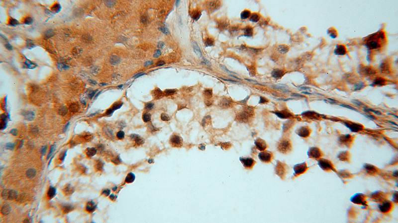 Immunohistochemical of paraffin-embedded human testis using Catalog No:111374(HDAC2-specific antibody) at dilution of 1:50 (under 40x lens)