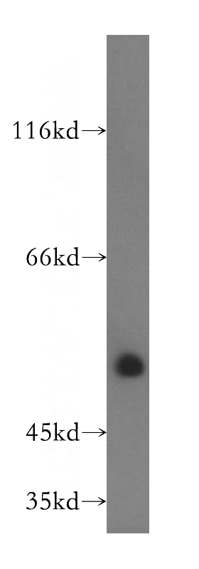 human heart tissue were subjected to SDS PAGE followed by western blot with Catalog No:117090(B3GALTL antibody) at dilution of 1:600