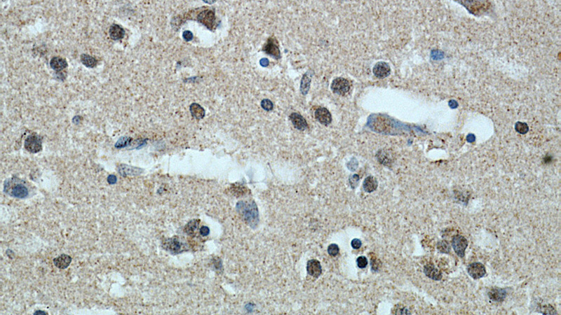 Immunohistochemical of paraffin-embedded human brain using Catalog No:113120(NeuN antibody) at dilution of 1:50 (under 40x lens)