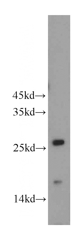 mouse brain tissue were subjected to SDS PAGE followed by western blot with Catalog No:113397(NT5M antibody) at dilution of 1:600