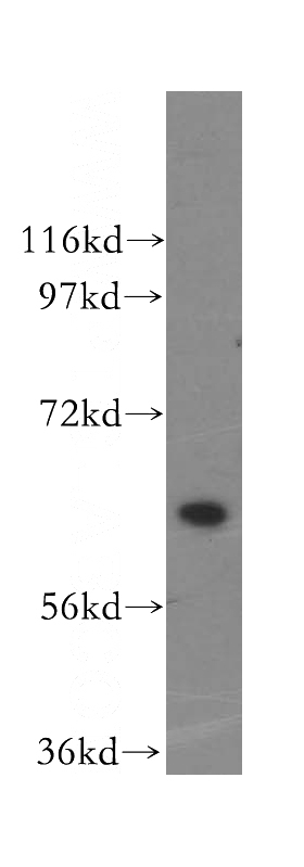 HeLa cells were subjected to SDS PAGE followed by western blot with Catalog No:111331(HACL1 antibody) at dilution of 1:500