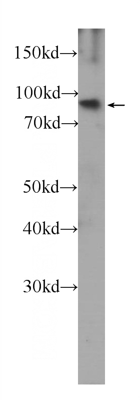 Y79 cells were subjected to SDS PAGE followed by western blot with Catalog No:107209(FGFR1 Antibody) at dilution of 1:1000