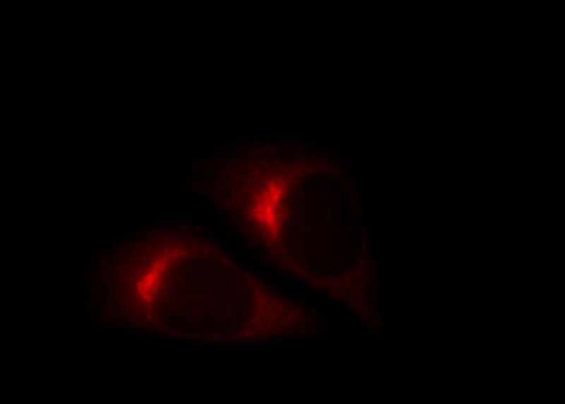 Immunofluorescent analysis of HepG2 cells, using COPE antibody Catalog No:109457 at 1:25 dilution and Rhodamine-labeled goat anti-rabbit IgG (red).