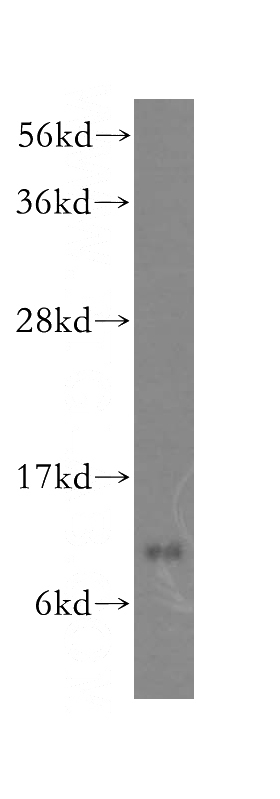 human heart tissue were subjected to SDS PAGE followed by western blot with Catalog No:114953(S100A1 antibody) at dilution of 1:500