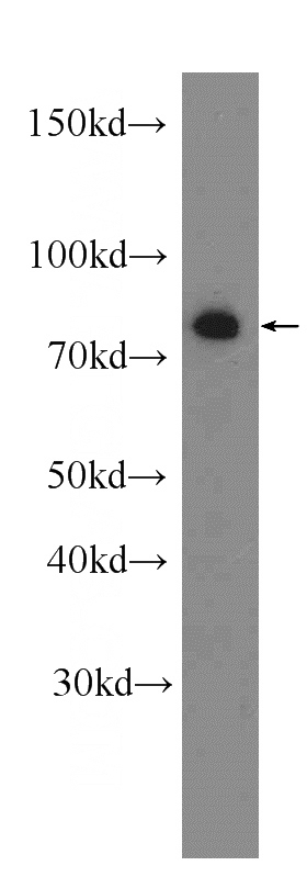 Jurkat cells were subjected to SDS PAGE followed by western blot with Catalog No:109327(CKAP2L antibody) at dilution of 1:1000