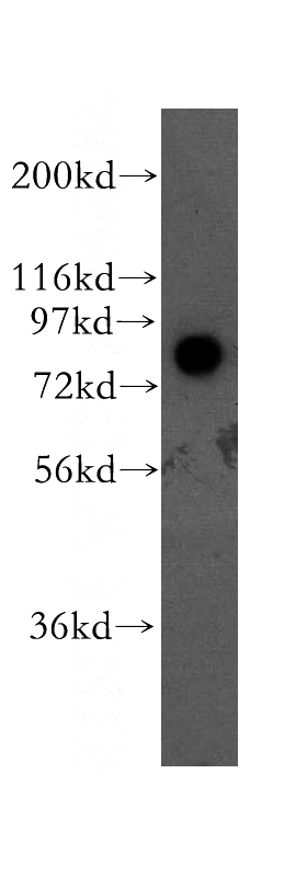 mouse testis tissue were subjected to SDS PAGE followed by western blot with Catalog No:112530(MFN2 antibody) at dilution of 1:400