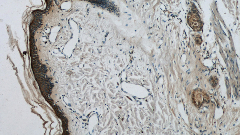 Immunohistochemistry of paraffin-embedded human skin tissue slide using Catalog No:112297(LOR Antibody) at dilution of 1:50 (under 10x lens)