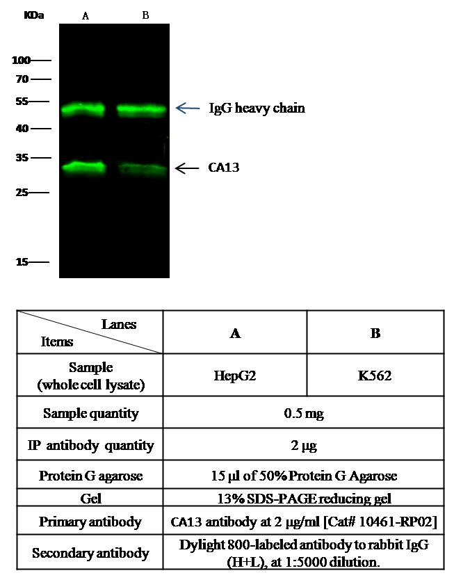 Carbonic Anhydrase XIII / CA13 Antibody, Rabbit PAb, Antigen Affinity Purified, Immunoprecipitation