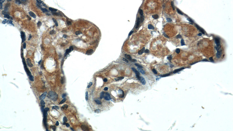 Immunohistochemistry of paraffin-embedded human placenta tissue slide using Catalog No:114659(RHOBTB3 Antibody) at dilution of 1:50 (under 40x lens)