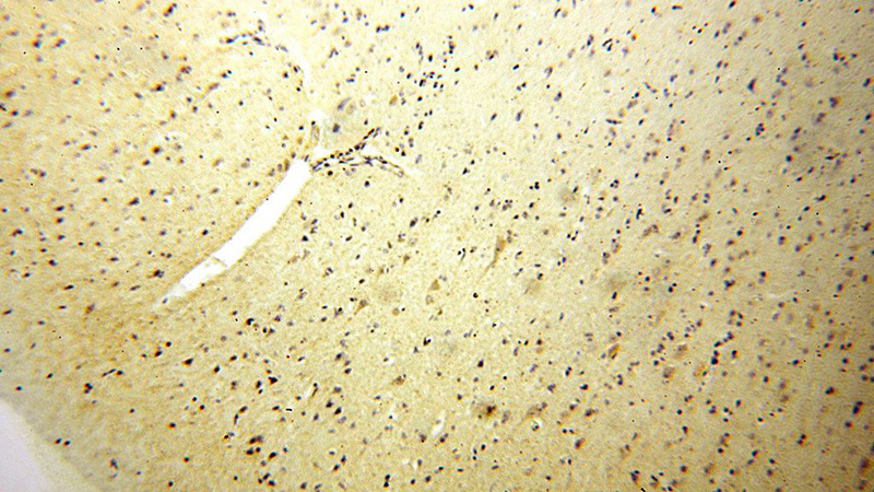 Immunohistochemical of paraffin-embedded human brain using Catalog No:111605(IDH3A antibody) at dilution of 1:100 (under 10x lens)