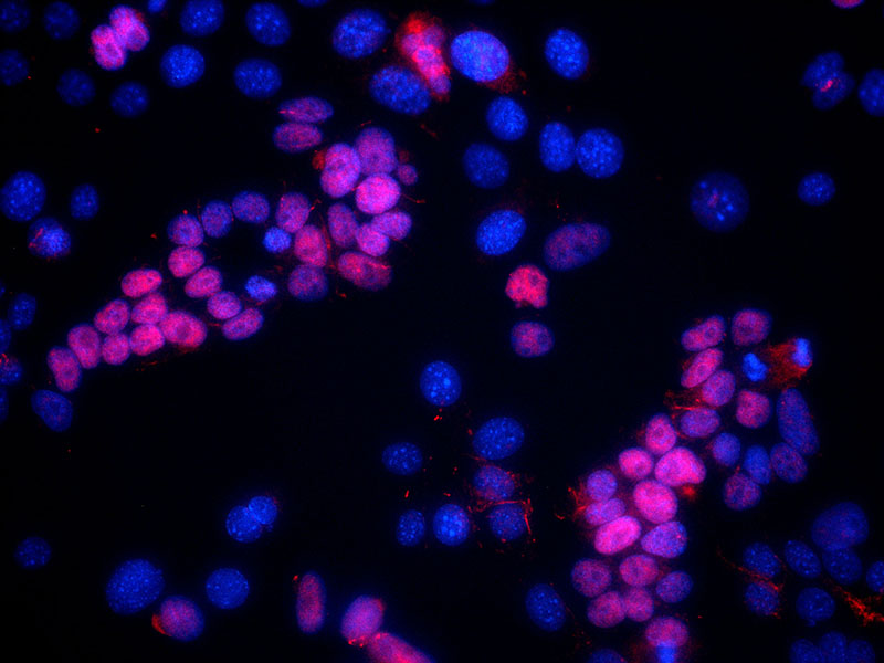 IF result of anti-SIX1(1:50) in p53-/- mammary epithelial tumor cells. Blue: hoechst nuclear stain, Red: SIX1 stain the mesenchymal cell which have undergone EMT.