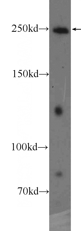 PC-3 cells were subjected to SDS PAGE followed by western blot with Catalog No:108264(ARHGAP21 Antibody) at dilution of 1:600