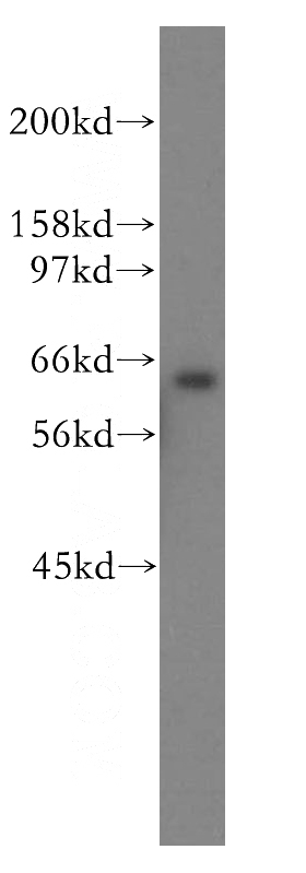 HEK-293 cells were subjected to SDS PAGE followed by western blot with Catalog No:115618(SSX2IP antibody) at dilution of 1:500