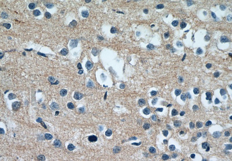Immunohistochemistry of paraffin-embedded human brain tissue slide using Catalog No:112680(KIAA1804 Antibody) at dilution of 1:50 (under 40x lens)
