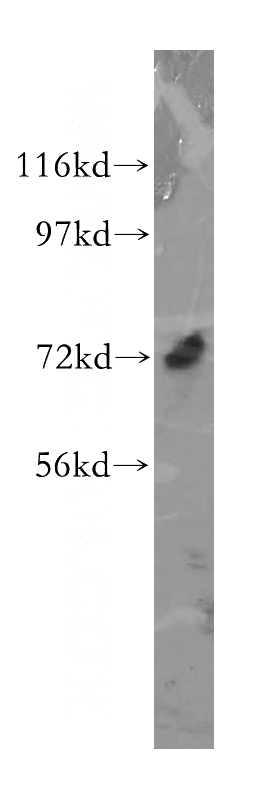 Y79 cells were subjected to SDS PAGE followed by western blot with Catalog No:112335(LRRC4C antibody) at dilution of 1:500