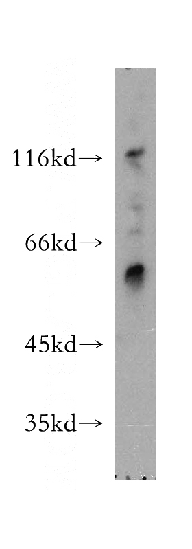 mouse ovary tissue were subjected to SDS PAGE followed by western blot with Catalog No:112427(MAP4K5 antibody) at dilution of 1:1000