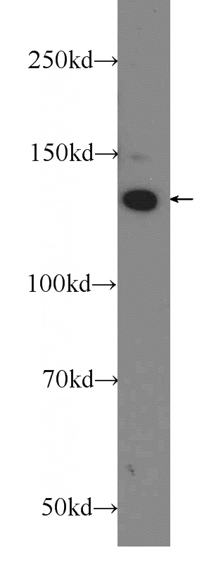 HeLa cells were subjected to SDS PAGE followed by western blot with Catalog No:109265(CEP135 Antibody) at dilution of 1:600