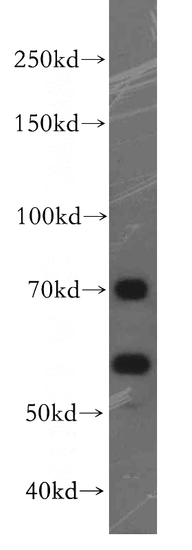 PC-3 cells were subjected to SDS PAGE followed by western blot with Catalog No:110616(FEM1B antibody) at dilution of 1:300