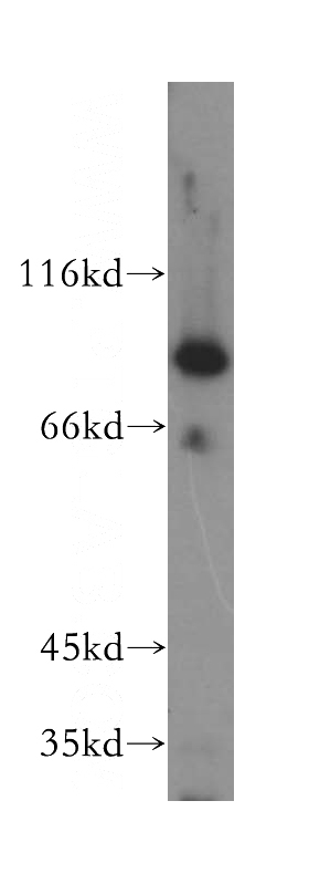 MCF7 cells were subjected to SDS PAGE followed by western blot with Catalog No:113555(ALDH18A1 antibody) at dilution of 1:500