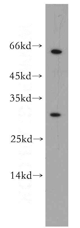 mouse liver tissue were subjected to SDS PAGE followed by western blot with Catalog No:114621(REX2 antibody) at dilution of 1:300