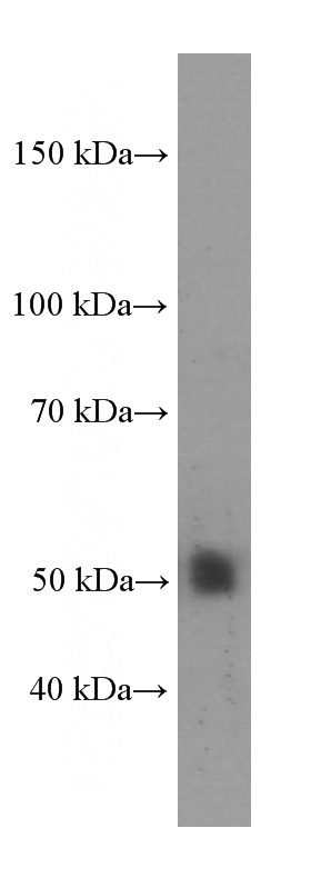 human liver tissue were subjected to SDS PAGE followed by western blot with Catalog No:107335(NR1H2 Antibody) at dilution of 1:1000