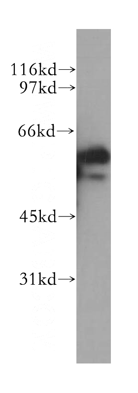 PC-3 cells were subjected to SDS PAGE followed by western blot with Catalog No:110489(ETV5 antibody) at dilution of 1:500