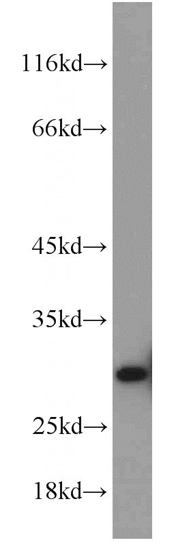 mouse brain tissue were subjected to SDS PAGE followed by western blot with Catalog No:115466(SNRPN antibody) at dilution of 1:800