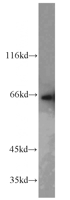 HeLa cells were subjected to SDS PAGE followed by western blot with Catalog No:114130(PPIL4 antibody) at dilution of 1:1000
