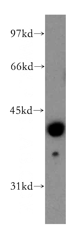 human liver tissue were subjected to SDS PAGE followed by western blot with Catalog No:110658(FMOD antibody) at dilution of 1:400