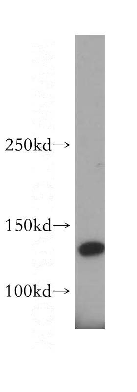 human heart tissue were subjected to SDS PAGE followed by western blot with Catalog No:109439(COL6A2 antibody) at dilution of 1:500