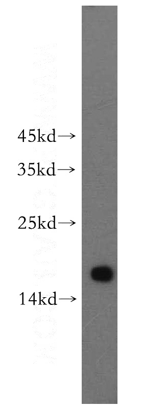 HeLa cells were subjected to SDS PAGE followed by western blot with Catalog No:114831(RPS16 antibody) at dilution of 1:500
