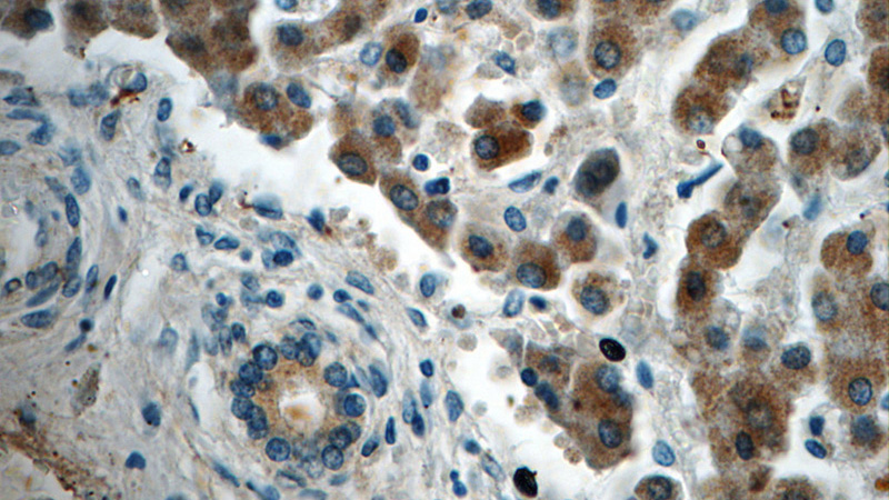 Immunohistochemistry of paraffin-embedded human liver tissue slide using Catalog No:111143(GPS2 Antibody) at dilution of 1:50 (under 40x lens)
