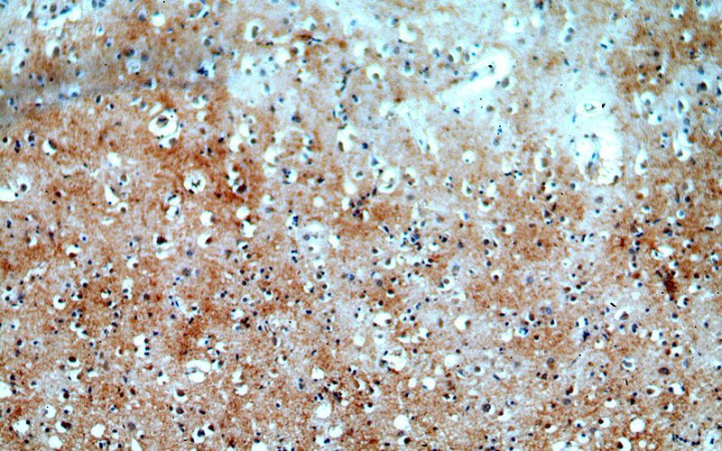 Immunohistochemical of paraffin-embedded human brain using Catalog No:116375(TTBK2 antibody) at dilution of 1:100 (under 10x lens)