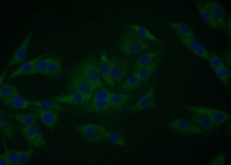 Immunofluorescent analysis of A375 cells using Catalog No:110394(EPS8 Antibody) at dilution of 1:25 and Alexa Fluor 488-congugated AffiniPure Goat Anti-Rabbit IgG(H+L)