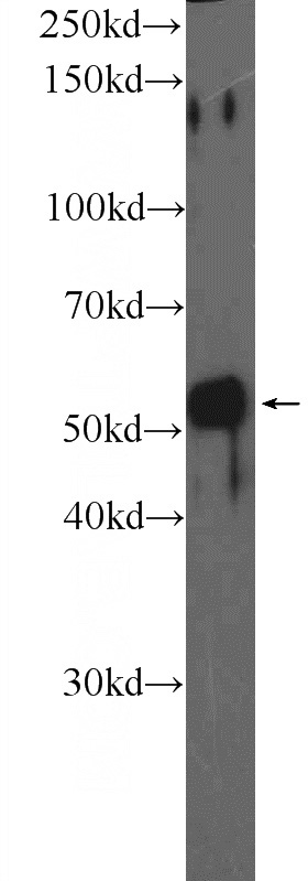 mouse liver tissue were subjected to SDS PAGE followed by western blot with Catalog No:110904(GCK Antibody) at dilution of 1:600